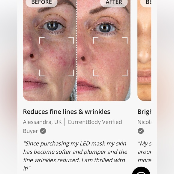 Nib Current body LED Red Light mask series 2 new $389 visible anti aging - Picture 11 of 17